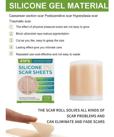 Buy Silicone Scar Sheets - 2 Boxes (1.6 x 60 Roll) for Effective Scar Removal | Reusable Silicone Scar Tape for All Types of Scars - International Shipping Available - Buy Online on GoSupps.com