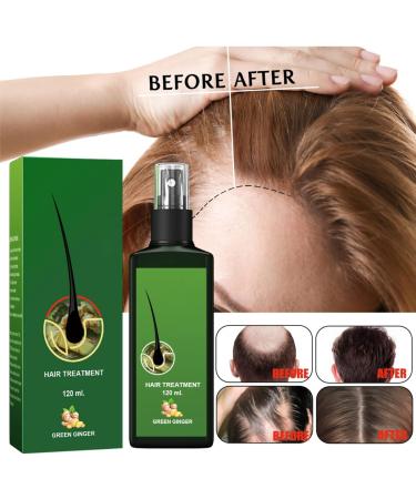 Hair Growth Serum Hair Lotion Hair Loss Treatments for Men Women Promotes Hair Thicker and Stronger Natural Nourishing Hair Growth Spray Hair Care for Dry Damaged Hair. (120ml) - Buy Online on GoSupps.com