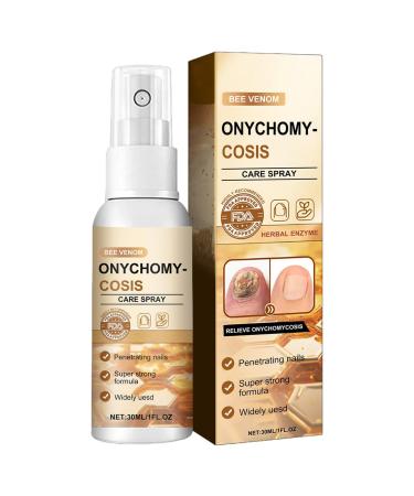 Toenail Cleaner Spray Toe Nail Strengthener Nail Care Spray Repair Toenail Repair Solution Nail Strengthener Spray Grey Nail Repair Broken Nail Repair Cracked Nail Solution 30ml Nail Repair