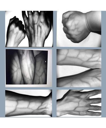 HNCXHX Vein Locator - Rechargeable Vener Finder & Intelligent Imaging Detector for Adults & Children - Clear Graphics for Accurate Results - Buy Online on GoSupps.com