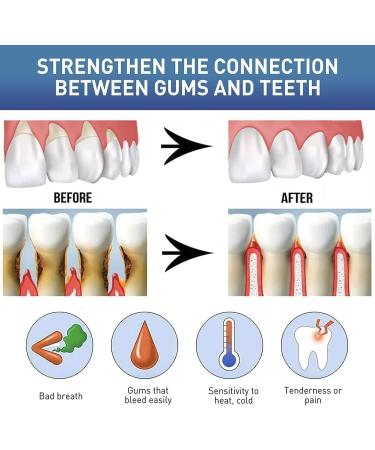 7 Day Active Gum Treatment Antibacterial Gum Treatment Gel Anti-Yellowness Serum for Stain Treatment Gum Treatment Gel Oral Cleaning - Buy Online on GoSupps.com