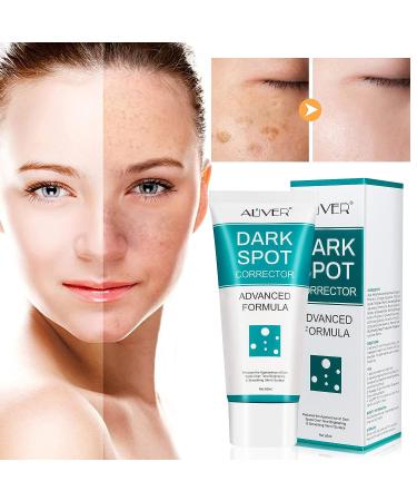 Dark Spot Corrector Cream for Face - Fade Black Precipitates, Remove Freckles & Spots - All Skin Tone Types - Buy Online on GoSupps.com