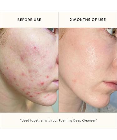 Lemon & Beaker Pore-Reducing Toner - Alcohol-Free Vegan Face Toner for Hydrated Skin & Minimizing Large Pores - 3.5 fl oz | Made in New Zealand | International Shipping - Buy Online on GoSupps.com