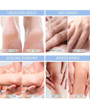 40% Urea Cream for Feet | Natural Organic Foot Cream for Dry Cracked Heels | Moisturizer for Feet Hands & Legs - Buy Online on GoSupps.com