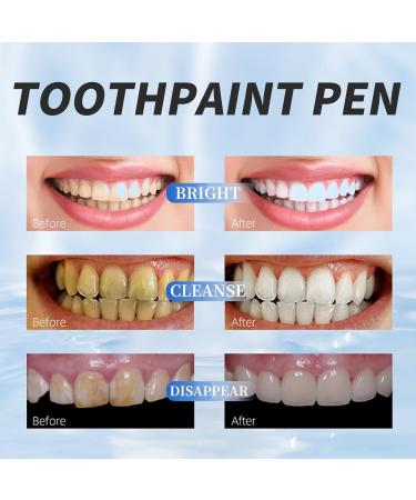 Teeth Gloss & Whitening Pen - Instant Stain Removal & Gentle Dental Cleaning | Abbey Teeth Whitening - Buy Online on GoSupps.com