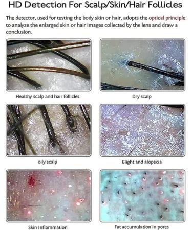 15 Inch Scalp Hair Follicle Detector 50X 200X Skin Hair Scalp Detector Multi Functional High Definition Rechargeable Skin Scalp Hair Follicle Detector - Buy Online on GoSupps.com