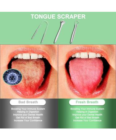 3-Piece Stainless Steel Tongue Scraper Set | Reusable Tongue Cleaner for Oral Hygiene & Fresh Breath | Durable Metal Tongue Care Tools - Buy Online on GoSupps.com