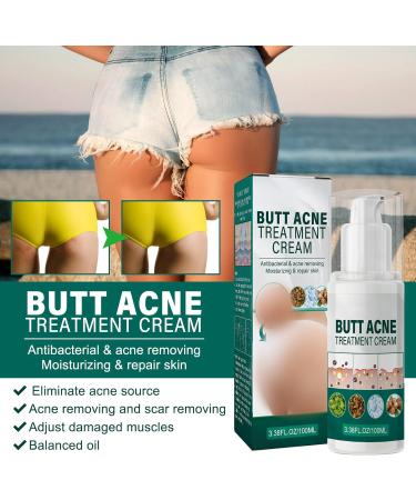 Shantou Yingji Acne cream for buttocks - Buy Online on GoSupps.com