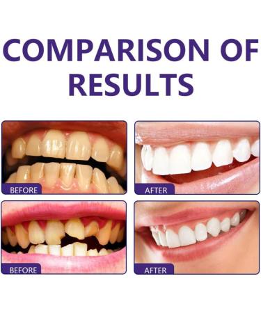 Teeth Repair Foam & Whitening Mousse | Pain-Sensitive Relief Fresh Breath Deep Clean | FOAM TOTASE - Stronger Teeth & Healthier Gums - Buy Online on GoSupps.com