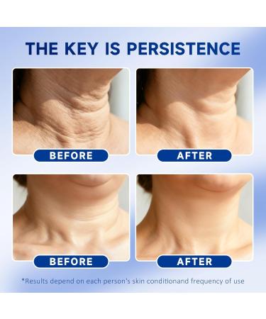 PUQIANNA Blue Firming Neck Cream with Retinol & Peptide - Intense Anti-Wrinkle Cream for Women Tightening Face & Neck Moisturizer with Collagen & Hyaluronic Acid Daily Lifting Treatment - Buy Online on GoSupps.com
