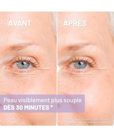  Soskin SOSKIN - Deep Wrinkle Filler - Targeted Anti-Wrinkle Eye & Lip Treatment - Filling Effect in 30 Minutes - 15 ml - Buy Online on GoSupps.com