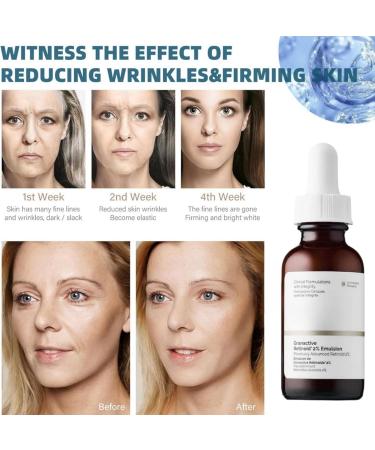 Granactive Retinoid 2% Emulsion Retinol Serum Retinol Serum for Face Retinol Anti-Aging Face Serum Face Moisturiser Retinol Face Serum Hydraulic Acid Serum for Face Anti Wrinkle Serum Fade Fine Lines - Buy Online on GoSupps.com