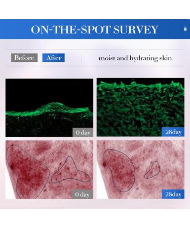 Double S rum Anti-Rides et Hydratant 2x30ml Acide hyaluronique Rose S rum Soin Repulpant et Raffermissant R duit les Ridules Pour une Peau Liss e Tonique et Confortable - Buy Online on GoSupps.com