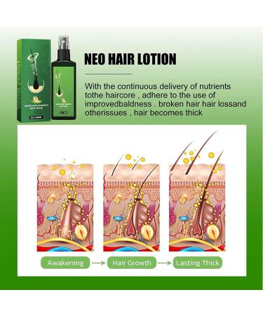 GrowthPlus Spray nourrissant au gingembre bio Growth Plus Spray nourrissant naturel pour cuir chevelu Spray nourrissant au gingembre pour homme et femme (1 pi ce) 1 pi ce. - Buy Online on GoSupps.com