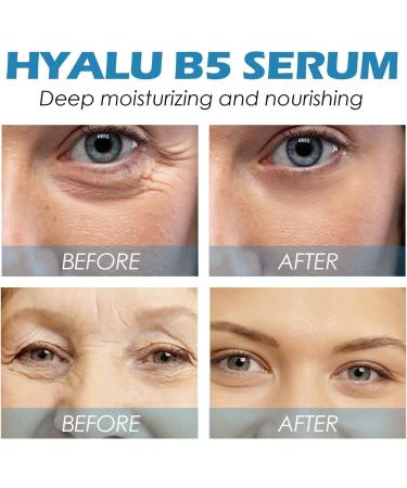 ZHBiwmatn 2024 New 3Pcs Hyalu B5 Serum Bo_tox Face Serum Bo_tox Stock Solution Facial Serum Bo_tox Stock Solution Anti Aging Serum Bo_tox in a Bottle Instant Face Tightening B_otox for Face Fade Fine 30ml/1.01fl.oz - Buy Online on GoSupps.com
