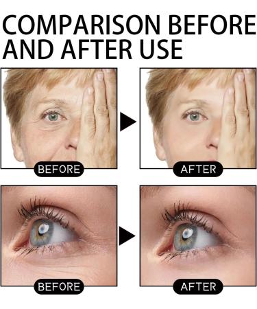 360 Micro Capsules Serum 30ml Hyaluronic Acid Anti-Wrinkle Serum Facial Moisturizer Lightening Spots Brightening Shrinking Pores (3pcs) - Buy Online on GoSupps.com