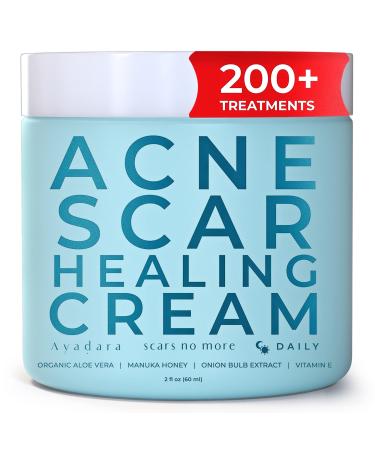 Acne Scar Healing Cream | Vitamin E Face Cream for Zit, Milia, & Blemish Scarring | Skin Repair & Removal Treatment for Old & New Pimple Marks & Dark Spots on Teens & Adults | 200+ Treatments by Ayadara