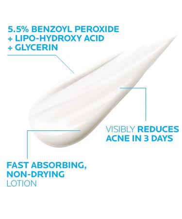 La Roche-Posay Effaclar Duo Acne Spot Treatment Cream with Benzoyl Peroxide - Blemish & Blackhead Treatment, Gentle & Effective for Sensitive Skin - Buy Online on GoSupps.com