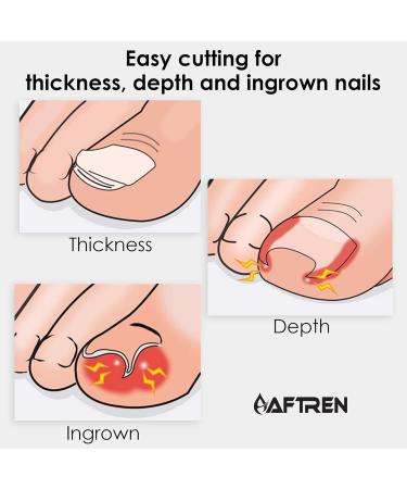 Professional Cuticle Nippers Precision Manicure Nail Clippers Stainless Steel Scissors Thick and Ingrown Nails Hospital Grade Podiatry Tool - Buy Online on GoSupps.com