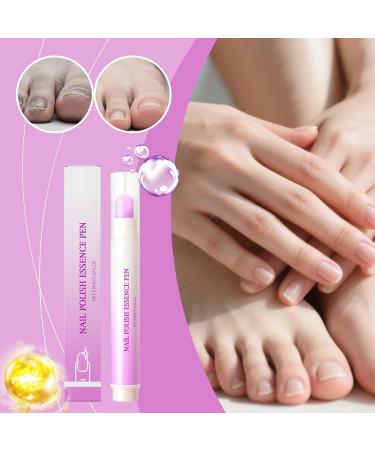 Huile Cuticules 3.5ml Stylo Liquide Renfor ateur Huile Hydratante | Pour Femmes Et Hommes Routine Quotidienne Apr s Manucure Soin Du Soir Matin Salon Voyage Toilette Et Entretien - Buy Online on GoSupps.com