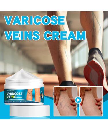 Cr me Apaisante pour les Jambes Creme Anti Varices Cr me pour Varices R paration des Jambes d'Araign e Varices Jambes Cr me Creme Anti Varices Cr me de Soin Hydratante Jambes 30G - Buy Online on GoSupps.com