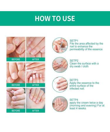 Nail Repair Essence for Fingernail & Toenail Fungus - Repairs, Protects, and Strengthens Nails (3 Pcs) - Buy Online on GoSupps.com