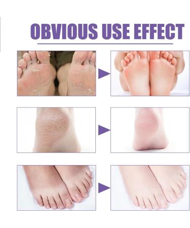 Foot Mask Foot Peel Mask Lavender & VC Exfoliating Foot Peel Mask Lavender Exfoliating Foot Mask Peel Feet Peeling Mask Exfoliating Foot Mask Foot Moisturizing Mask - Buy Online on GoSupps.com