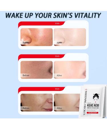 Kojic Acid Face Masks Face Masks Skincare with Kojic Acid Hyaluronic Acid Nicotinamide Brightening Firming Anti Aging Sheet Mask Evens Tone Moisturize Soothe Gift Set for Women - Buy Online on GoSupps.com