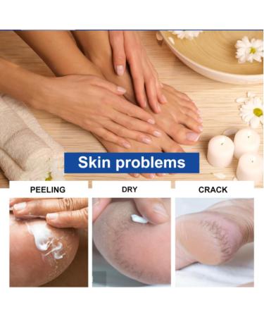 Urea Foot Cream 40 Percent - Urea Cream Plus 2% Salicylic Acid - Cracked Heel Repair Cream - Urea Cream for Feet with Coconut Oil Tea Tree and Aloe Vera - Callus Remover and Soften - Buy Online on GoSupps.com