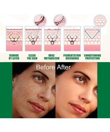  Nuvilo Dark Spot Correcting Glow Niacinamide Serum Face Serum for Dark Spots Brightening Skin Care for Hyperpigmentation Anti-Aging Moisturizer (4 Pieces) - Buy Online on GoSupps.com