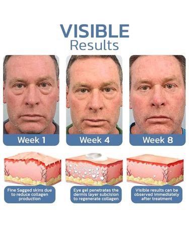 3Pcs Awaken Peptide Eye Gel Set for Lifting, Depuffing & Reducing Under Eye Bags - Buy Online on GoSupps.com