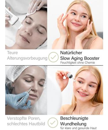 ROSENTAL Organics Hyaluronic Serum (30 ml) High Dose Organic Hyaluronic Acid Moisturiser for the Face Natural Cosmetics 100% Natural - Buy Online on GoSupps.com