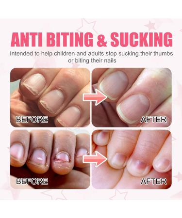 Anti Nail Biting Polish Nail Biting Prevention Stop Deterrent Nail Polish Treatment Clear Nail Polish Stop Nail Biting Nail Varnish For Adults & Children Natural Plant Extract - Buy Online on GoSupps.com