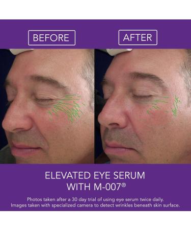 Omni Bioceuticals Elevated Eye Serum with Growth Factors & M-007 15ml - Buy Online on GoSupps.com