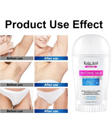Underarm Body Balm - Kojic Acid Body Cream for Dark Skin - Collagen Body Cream for Sensitive Areas - Even Skin Tone - Armpit Body Cream - Improve Skin Reduce Odor - Buy Online on GoSupps.com