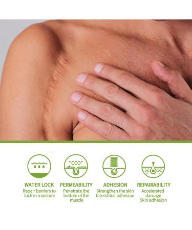 Goopgen Advanced Scar Repair Serum - Medical Grade Nature Treatment for All Types of Scars (2pcs) - Buy Online on GoSupps.com