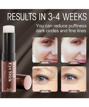 Retinol Eye Stick - Anti-Aging Eye Balm for Dark Circles Puffiness & Fine Lines - Brightening Under Eye Cream for Radiant Skin - Buy Online on GoSupps.com