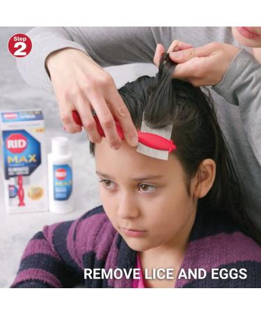 RID MAX Lice Removal Kit - Pesticide Free, Easy-to-Use, 100% Effective - Includes RIDvantage Comb and Solution (4 Ounces) - 2 Piece Set - Buy Online on GoSupps.com