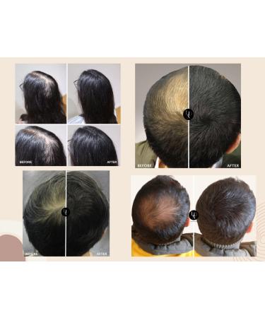  LDN Professional LDN Professional Hair Fibers No. 1. Hair fibers for hair loss and thinning hair instantly thicken hair naturally 22g bottle of hair fibers (medium brown) - Buy Online on GoSupps.com