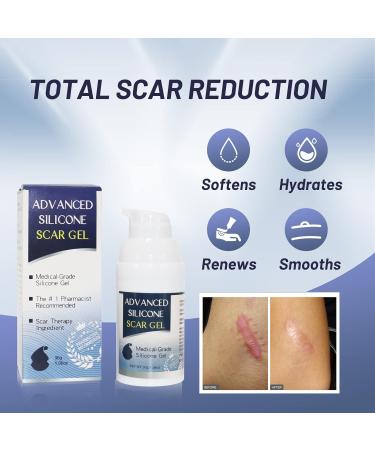 Scar Gel for Face Advanced Scar Remover Anti Scar Cream for Face Silicone Scar Gel Scar Cream Scar Removal Cream for Cesarean Burns and - Buy Online on GoSupps.com