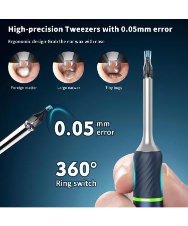BEBIRD NOTE5 Pro Ear Wax Removal Tool - 1080p Smart Visual Ear Cleaner with Camera | Safe & Professional Endoscope for Kids Adults & Pets (Blue) - 3 Light Modes & WiFi - International Shipping Available - Buy Online on GoSupps.com