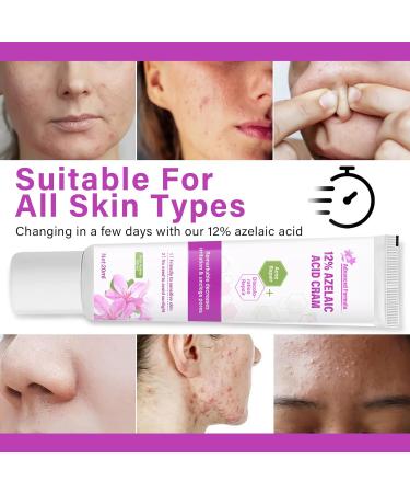 Azelaic Acid Serum Cream 12% Azelaic Acid Cream Redness Relief Face Balance Excess Sebum 20ml - Buy Online on GoSupps.com