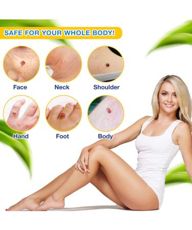 Ulensy Skin Tag Remover - Extra Strength Liquid for Fast, Pain-Free Skin Tag Removal - Natural Plant Extracts, No Scars - Easy Application (Natural Blue) - Buy Online on GoSupps.com