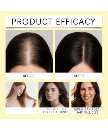  Generisch Rosemary hair growth shampoo for women and men organic hair growth shampoo with hydrolyzed keratin anti-hair loss repairing and nourishing scalp treatment - Buy Online on GoSupps.com