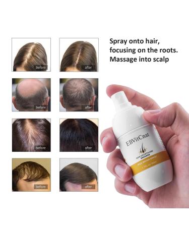 Rice Water Hair Growth Serum - Fermented Rice Water for Thicker Stronger Fuller Hair - Ideal for Men & Women - Restore Damaged Hair - Buy Online on GoSupps.com