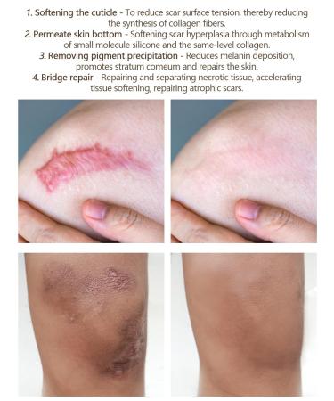 Vibrant Glamour Cayman Repair Gel: Acne Scar & Skin Scar Removal Ointment - 20g - Buy Online on GoSupps.com