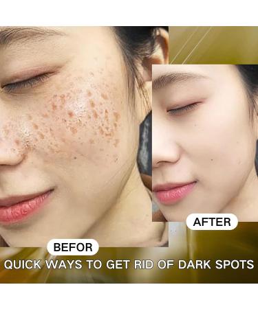 Tranexamic Acid Serum Tranexamic Acid Skin Brightening Serum Dark Spot Correcting Glow Serum Moisturiser For Acne Prone Skin with Hyaluronic Acid Arbutin Hyperpigmentation and Even Skin Tone - Buy Online on GoSupps.com