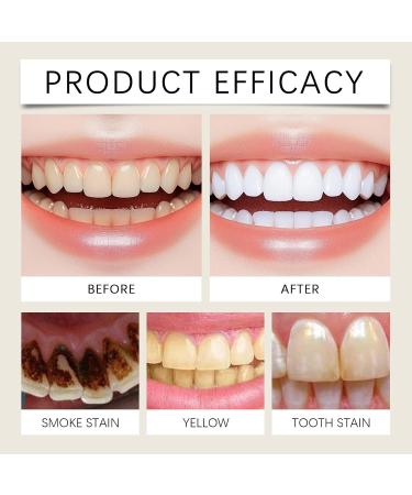 Brightening Toothpaste - Gentle Stain Removal Long-Lasting Mint Fresh Breath Daily Oral Care for Brighter & Attractive Teeth(2PCS) - Buy Online on GoSupps.com