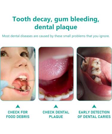 Mouth Mirror with LED Light - 4-Piece Dentist-Level Oral Care Set | International Shipping Available - Buy Online on GoSupps.com