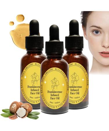 Frankincense Resin Infused Organic Black Seed, Frankincense Resin Oil for Face, Face Anti-Aging Miracle Facial Moisturizer, Castor Oils, Smooth Fine Lines and Wrinkles (3)